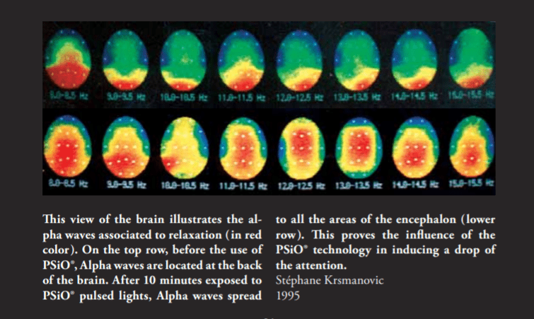 Psio alpha brainwaves